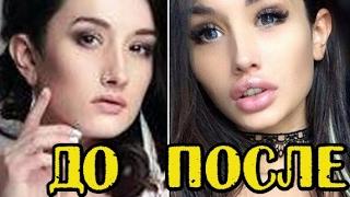 УЧАСТНИЦЫ ДОМ 2 ДО И ПОСЛЕ ПЛАСТИКИ