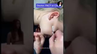 Amazing Ear  magic trick#shorts #viral #youtubeshorts #magic