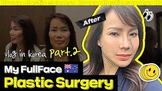 Complete Korean Plastic surgery Makeover│Middle aged woman finds her newself (Part2)