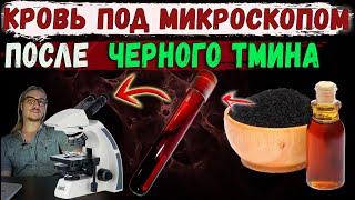 Черный тмин кровь под микроскопом. Наглядные противовоспалительные свойства.