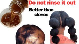 NO JOKE! Overnight Hair Growth Spray For Longer and Thicker Hair. 10X Better than Clove Water