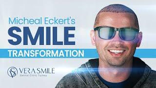 Michael's Stunning Smile Makeover: A Journey to Perfect Teeth!