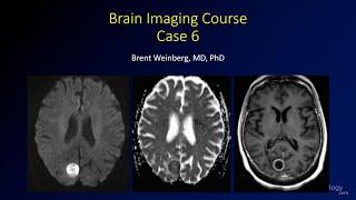 Neuroradiology board review 2 case