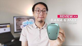 Cochlear BAHA 6 Max Full Review (2021): Is It Worth It? [CC]