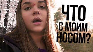 VLOG:ЧТО С МОИМ НОСОМ? живём с подругой одни в другой стране/Латвия