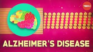 What is Alzheimer's disease? - Ivan Seah Yu Jun