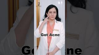 Does Stress Cause Pimples? | Acne caused by Stress | Acne Treatment | #acnetreatment #sridevi