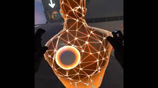 BONELAB the null body is very reflective