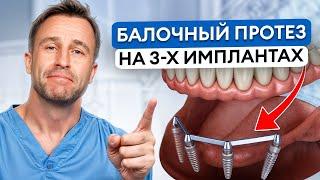 Самый СЛОЖНЫЙ случай имплантации! / КАК установить протез, если НЕТ ЗУБОВ?