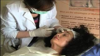 Platelet Rich Plasma Therapy (PRP)/Vampire Facelift Treatment at The Otto Clinic