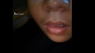 OME TV ULAR KASUR part. 10