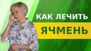 Ячмень на глазу. Как вылечить дома.