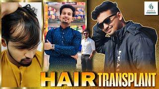 Hair Transplant in indore | Best Results & Cost of Hair Transplant in indore