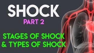 Stages of Shock | Types of Shock | Shock (Part 2)