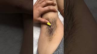Which wax is best for thick hair?#makeoverbyanita002 #waxing #waxingtreatment #beautytips #nailart