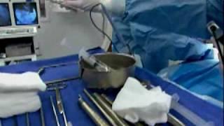Laser Spine Institute - Educational Television