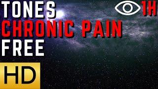 Alpha Vibration Tones for Chronic Pain