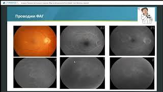 Заседание ЧООР Общества офтальмологов России. Диабет глаза. Проблемы и решения. 19.05.23