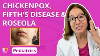 Chickenpox, Fifth's Disease, & Roseola: Alterations in Health - Pediatric Nursing | @LevelUpRN