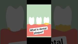 Dental plaque #shorts #ytshorts #dentalhygiene #dentalplaque #dentomedicalogy