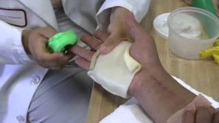 Occupational therapy For Hand, Shoulder, & Rotator Cuff Injuries after Traumatic Motorcycle Accident