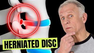 10 Surprising Things To Avoid With Herniated Disc & Sciatica