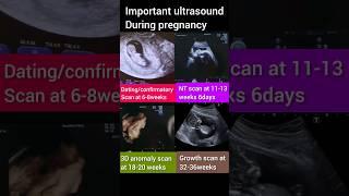 Important scan during pregnancy||shorts