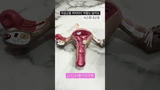 자궁근종 - 근층내근종