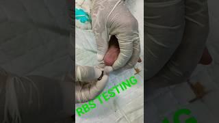 RBS TESTING SUGAR LEVEL TESTING  AFTER #VENTALATER #NICU #BABY #SHORT #VIDEO #RBS #CHEK #VIRAL