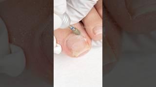 Can MelodySusie’s nail drill and bits be used for pedicure? #nails #toenails #naildrill #nailtech