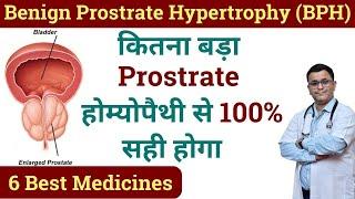 BPH homeopathic treatment Enlarged Prostrate homeopathic treatment BPH homeopathic medicine