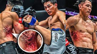 How Did Akimoto Survive Petchtanong’s Body Shots!?  Fight Highlights