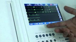 Introducing Carewell 1112M 12-channel ECG