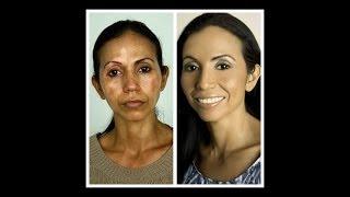 Vitiligo Makeup Tutorial | Margaret Kimura author of "Asian Beauty" | Makeup School
