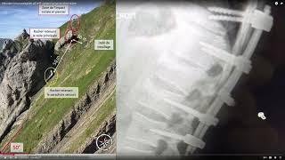 Safety knife in paragliding: avoid beeing dragged by helicopter downwash