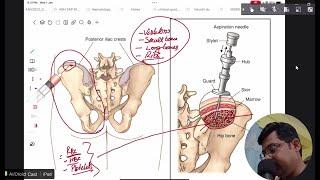 Bone marrow aspiration and biopsy/Process/Indications/Medschool simplified