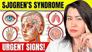 10 ALARMING SJOGREN'S Syndrome Symptoms: Rheumatologist Explains