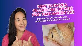 How to Shave a CRACKED Heel! (ASMR) by Miss Foot Fixer Marion Yau