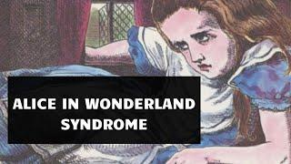 Alice in Wonderland Syndrome