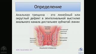 Киценко Ю.Е. Анальная трещина. Электив «Основы колопроктологии»