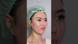 Surgery Transformation is not just about a change in appearance, but about finding a new confidence!
