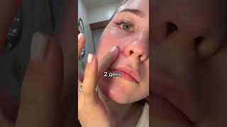 Сыворотка, которая, как ластик Арт 142054898 ДО