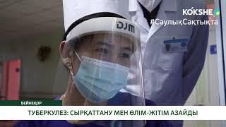 ТУБЕРКУЛЕЗ: СЫРҚАТТАНУ МЕН ӨЛІМ-ЖІТІМ АЗАЙДЫ