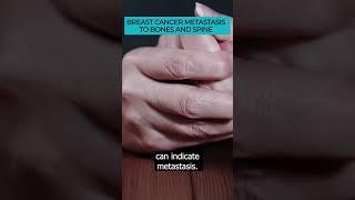 Recognizing Symptoms of Breast Cancer Metastasis to Bones and Spine ️#Cancer #Metastasis