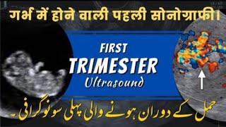 Early pregnancy sonography|booklet ch 1|early obs scan|First trimester obstetric usg|#earlyscan.