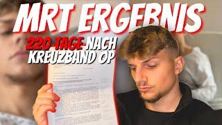 MRT Ergebnis ist da: Kreuzband-Vernarbung I Tag 220 nach der OP I FabiWb