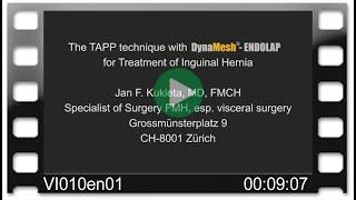 DynaMesh®-ENDOLAP - OR-Video: TAPP technique for Treatment of Inguinal Hernia