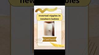 "Unusual Baby Feature: Do Inverted Nipples Require Attention?"