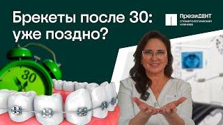  Брекеты после 30 лет - стоит ли устанавливать? Брекеты после 30 лет.