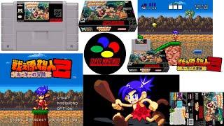 Trailer,manual,ROM,ISO,capa,box3d,cartucho,imagens, Congo's Caper (Super Nintendo SNES)(1992)